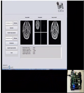 Hardware /software Co-design pour la compression des images médicales DICOM